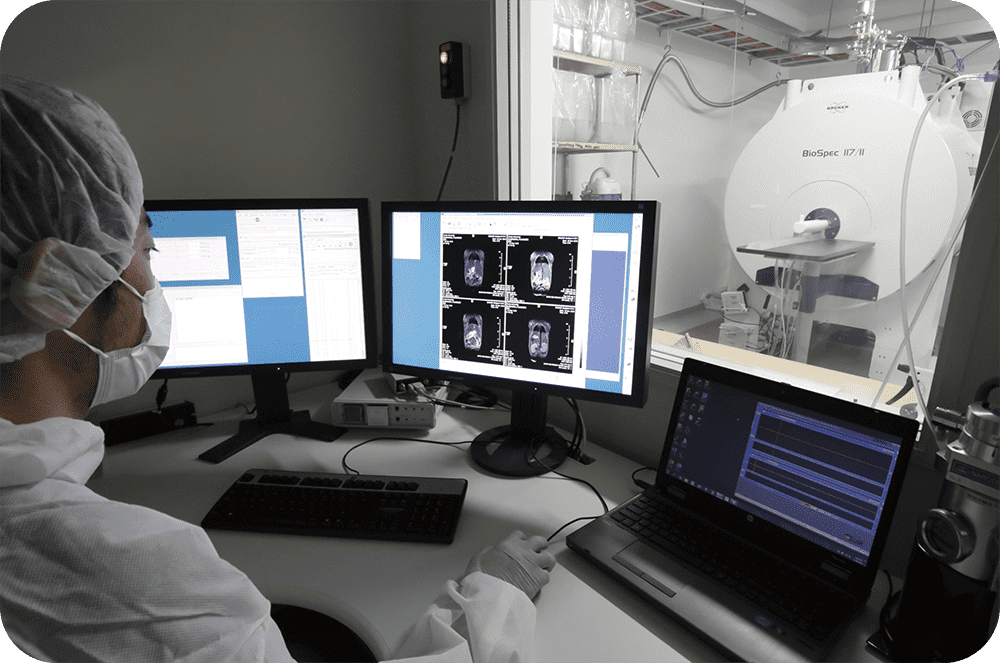 高性能のMRI装置